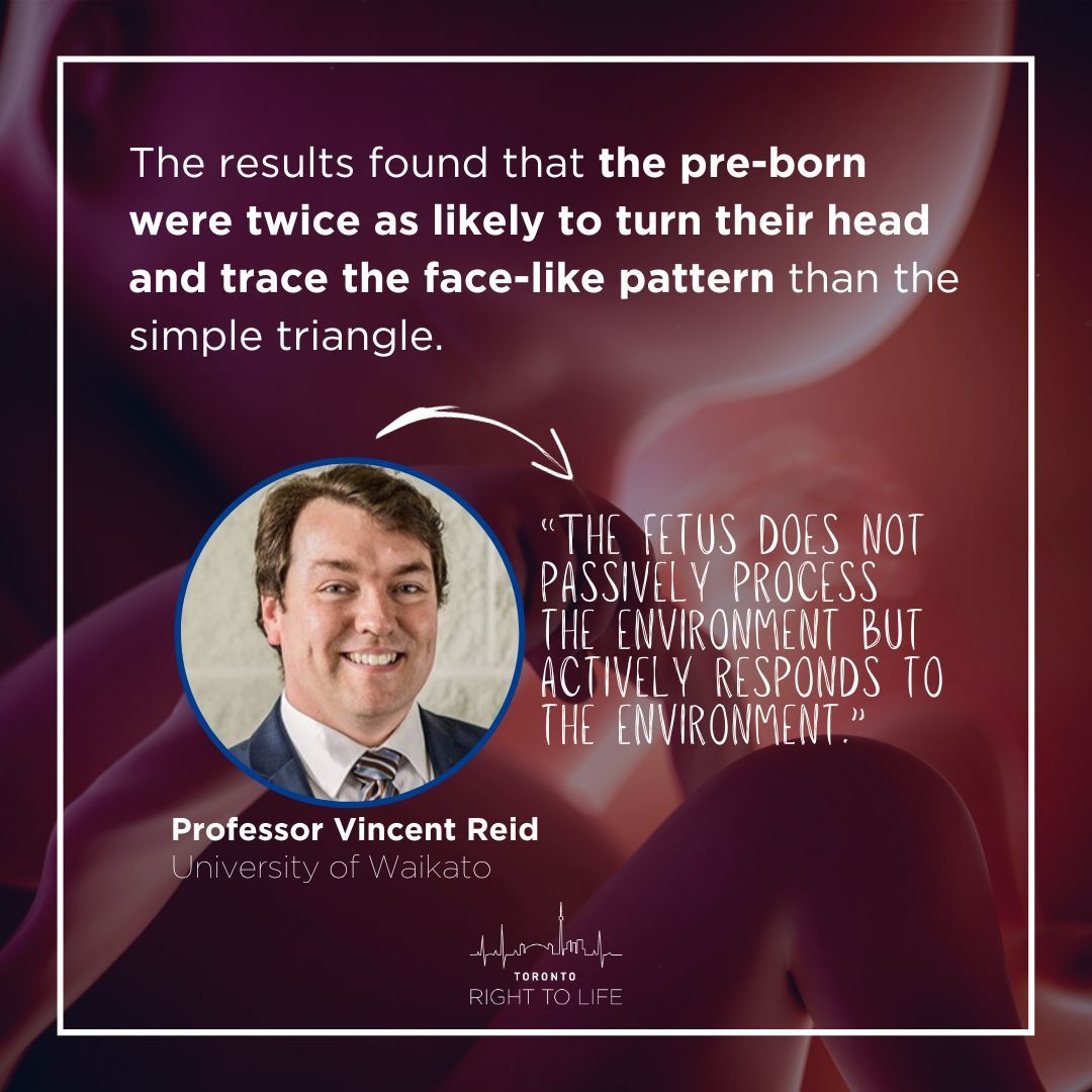 righttolifeTO's tweet image. In a new study, developmental psychologists have uncovered that pre-born babies are capable of developing preferences for faces even before they have seen one. Check out this post to learn more!
#prolife #preborn #fetus #science #prolifeto #pregnancy #abortion