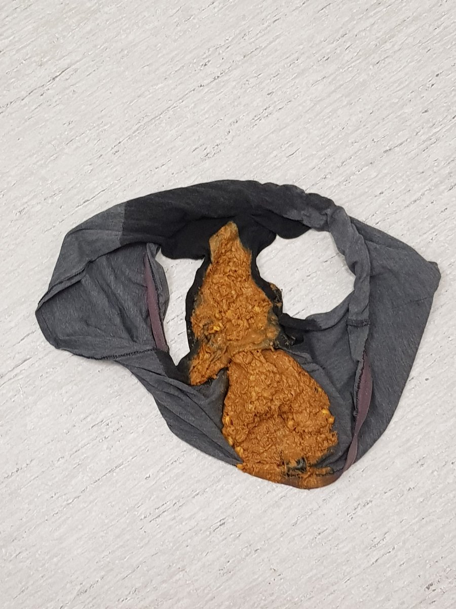 OnyxMagenta's tweet photo. A big mushy morning bulge like this one surely felt awesome to sit in💩🥰❤ #pantypoop #poop #scat #skatkink #poopy #scatfetish #scatgirl #stinky #soiling #pantymessing #pantypooping #mushy https://t.co/FUei4Quouu