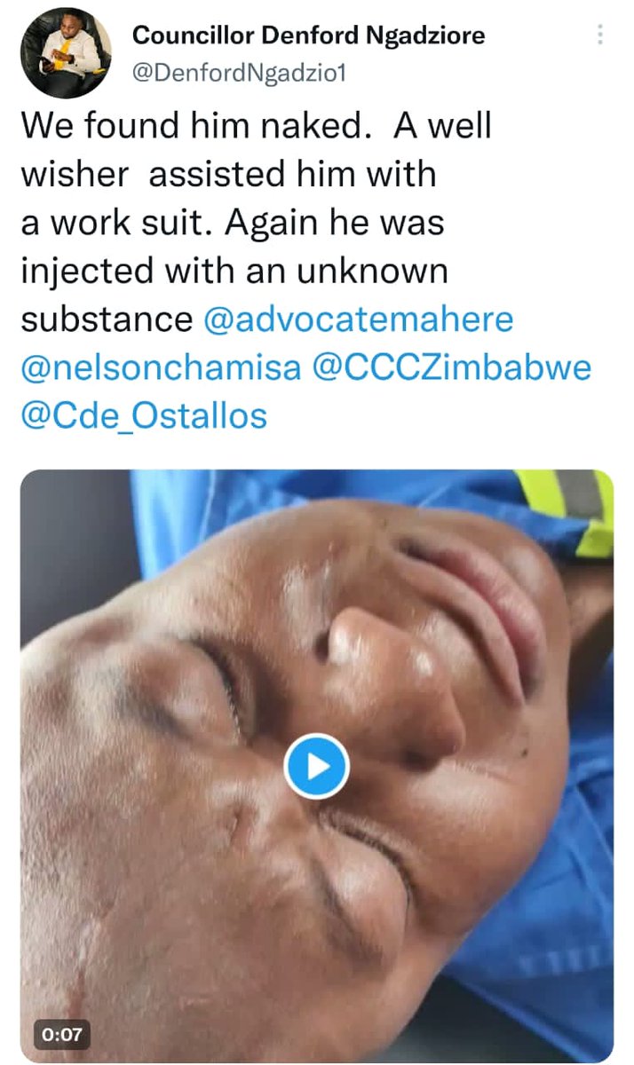 This is wrong, horrible and totally unacceptable. The perpetrator must be arrested and tried. I wish Hon Takudzwa Ngadziore, a speedy recovery. We must all work to build a Zimbabwe in which all citizens, whatever their politics, enjoy true freedom.