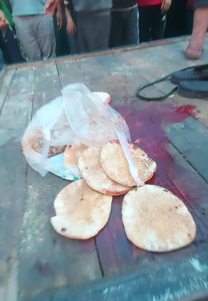 @Jales_tinian2 <a href="/uzisall/">أســ</a> Above the pure blood, the last loaves of bread, the last attempts at survival.
This is the height of Arab disappointment.