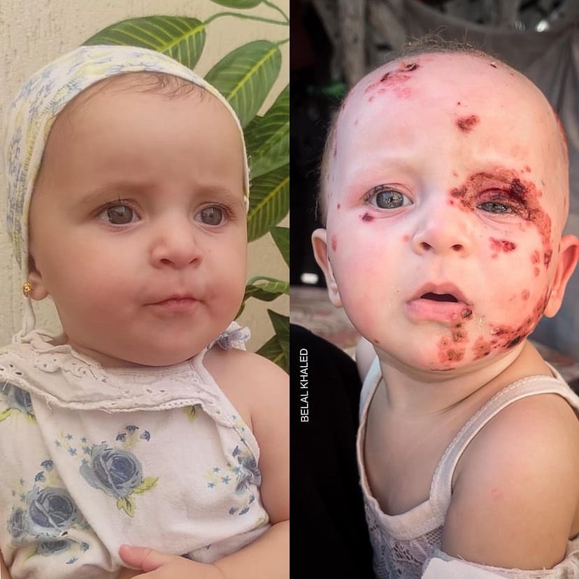 islamasalya88's tweet photo. Dünya sustukça siyonist azmaya devam ediyor..
📍 Filistin - Gazze https://t.co/YS0MerP8X0