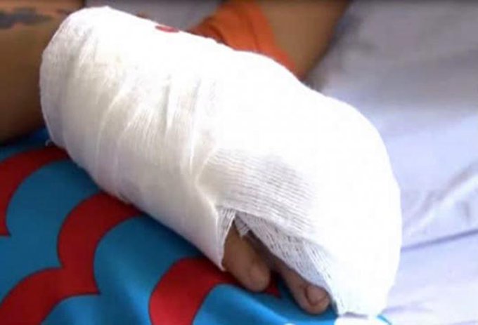 ATB_Radio's tweet image. 𝗡𝗶ñ𝗮 𝗱𝗲 𝟵 𝗮ñ𝗼𝘀 𝗲𝘀 𝗾𝘂𝗲𝗺𝗮𝗱𝗮 𝗲𝗻 𝗹𝗮𝘀 𝗺𝗮𝗻𝗼𝘀 𝗽𝗼𝗿 𝘀𝘂𝘀 𝗱𝗼𝘀 𝗵𝗲𝗿𝗺𝗮𝗻𝗼𝘀➡️ atb.com.bo/2023/11/01/nin… #niñaquemada #hermanos #internada #ATBNoticias