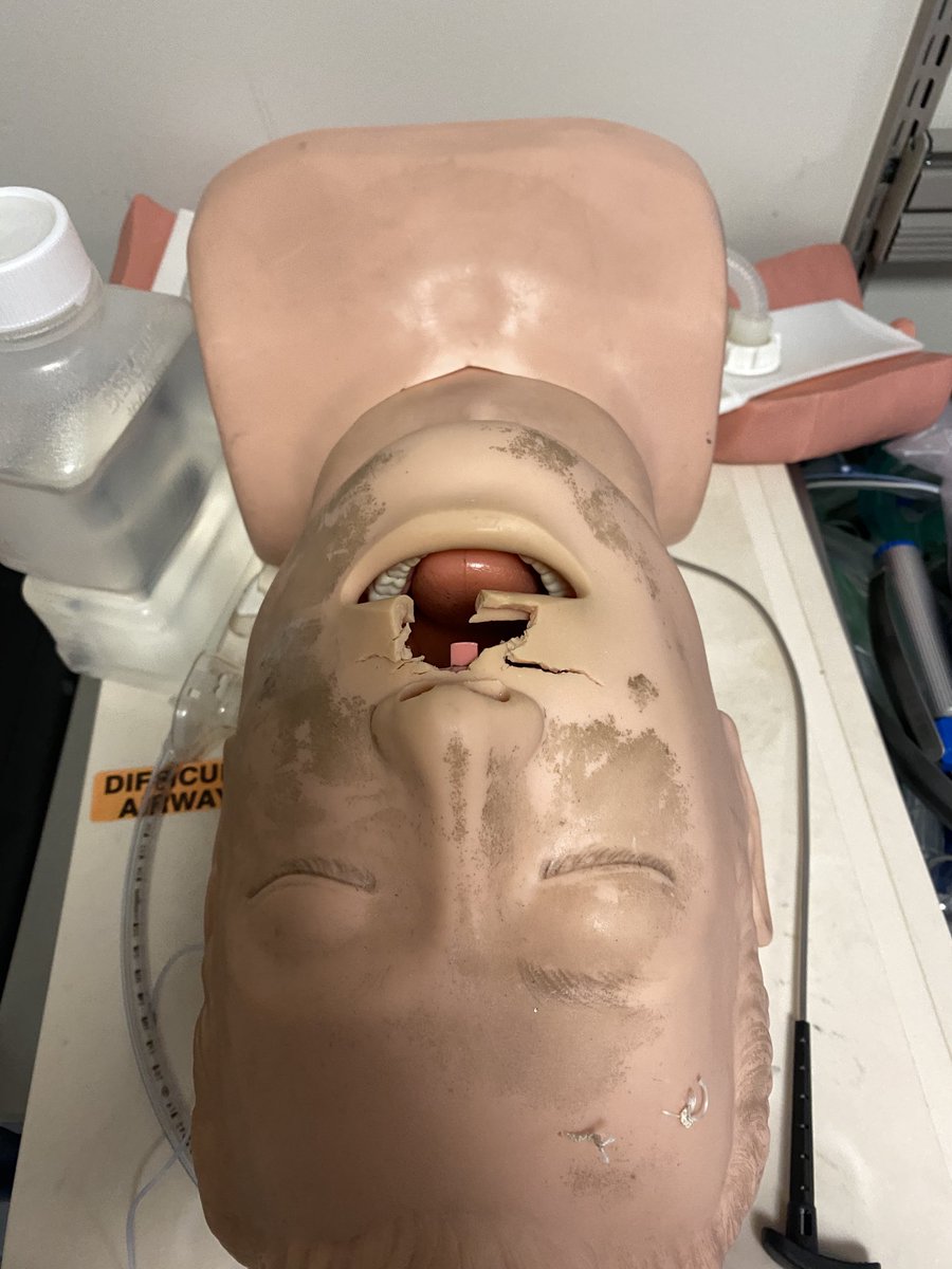RunnelsSean's tweet photo. Visiting a university airway lab today. A well used intubation head. Real world evidence of the force on tissue with DL. Time to leave DL behind and treat tissue with the respect deserved #intubation #universalVL https://t.co/w4Io2TBchM