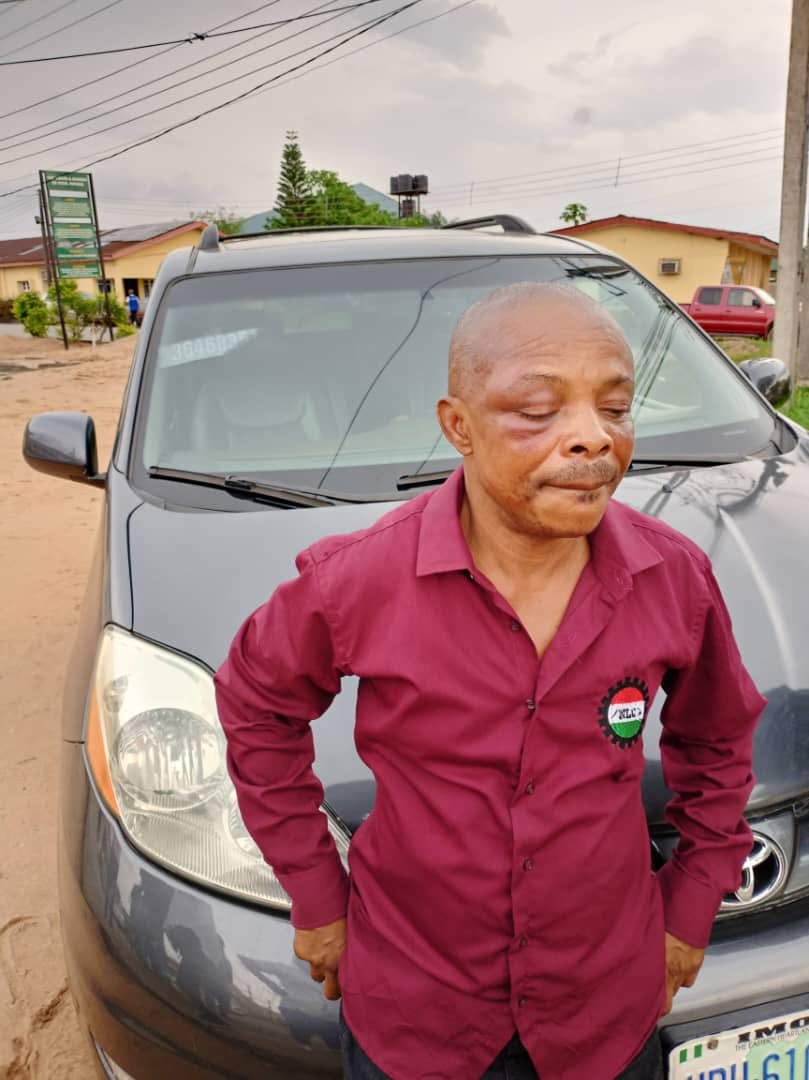 sowore's tweet photo. This barbarism is unacceptable, @HopeUzodinma sent thugs to assault and possibly assassinate @NLCHeadquarters President Joe Ajaero, the @NLCHeadquarters ought to shut down the country until the Imo State Governor and his thugs are removed from office. #RevolutionNow https://t.co/tOvQfOy45k