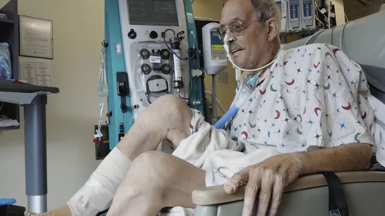 Domuz kalbi nakledilen hastanın vücudu 6 hafta dayandı, daha sonra vücut organı reddetti.