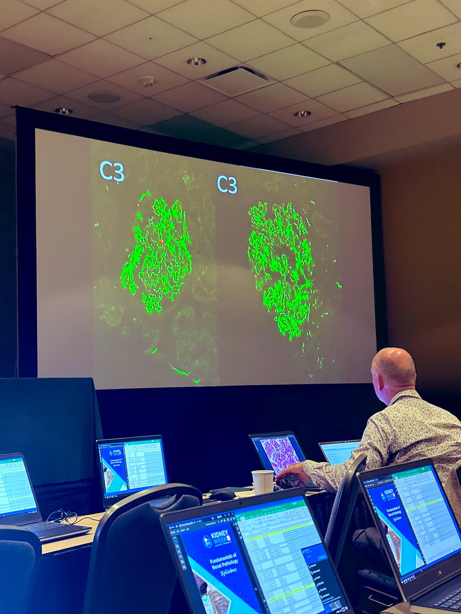 theglasspusher's tweet image. Fantastic start to the #earlyprogram in #renalpath at #KidneyWk2023 @ASNKidney @ASNAdvocacy @Renalpathsoc @AgnesFogo @ldcornell