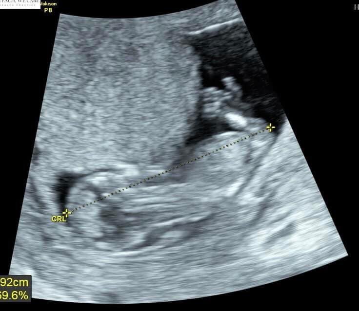 Barry Fitzgerald Sr tweet media