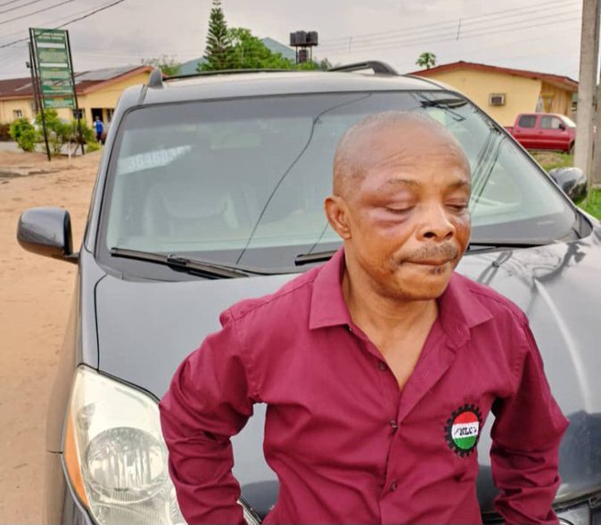 IntelRegion's tweet photo. BREAKING: NLC President Ajaero Hospitalized After Brutal Attack

The President of the Nigeria Labour Congress (NLC), Comrade Joe Ajaero, has been hospitalized after a brutal attack by police officers during a union protest in Imo State.

Ajaero sustained injuries, including a completely shut right eye, and was taken to an unknown location, where he was further assaulted.

His personal belongings, including phones and money, were reportedly taken from him during the incident.

The Imo State Police Command initially denied the arrest of the labor leader, stating that he was placed in protective custody.

The police claimed that Ajaero was in Owerri as part of NLC's arrangements to mobilize workers for a protest rally, during which scuffles and arguments occurred, leading to an attack on him by a mob.

Ajaero is receiving medical attention at the Federal Medical Centre in Owerri.

More details shortly...