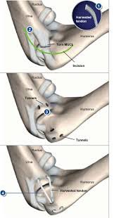 Pov you are <a href="/jaidon_14/">Jaidon Vega 14</a> and @juanjanaya entering your senior season