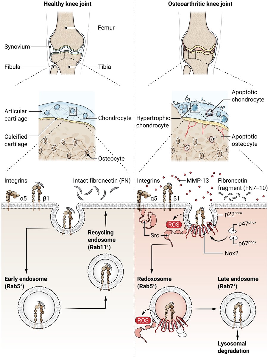 scisignal's tweet photo. A new study shows that fragments of #fibronectin—but not full-length protein—can drive signaling pathways involved in #osteoarthritis by triggering the secretion of #MMP13 and reactive oxygen species production in chondrocytes. https://t.co/nIAnk6t903; https://t.co/HLUamUGSxe https://t.co/SkYtWsRLiv