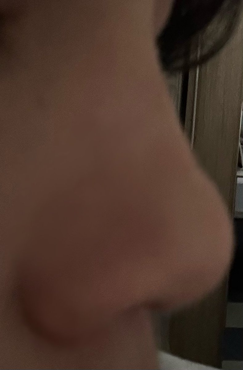 Necesito una humilde opinión de mi nariz, siento q la dismorfia corporal me hace pensar q es feisima