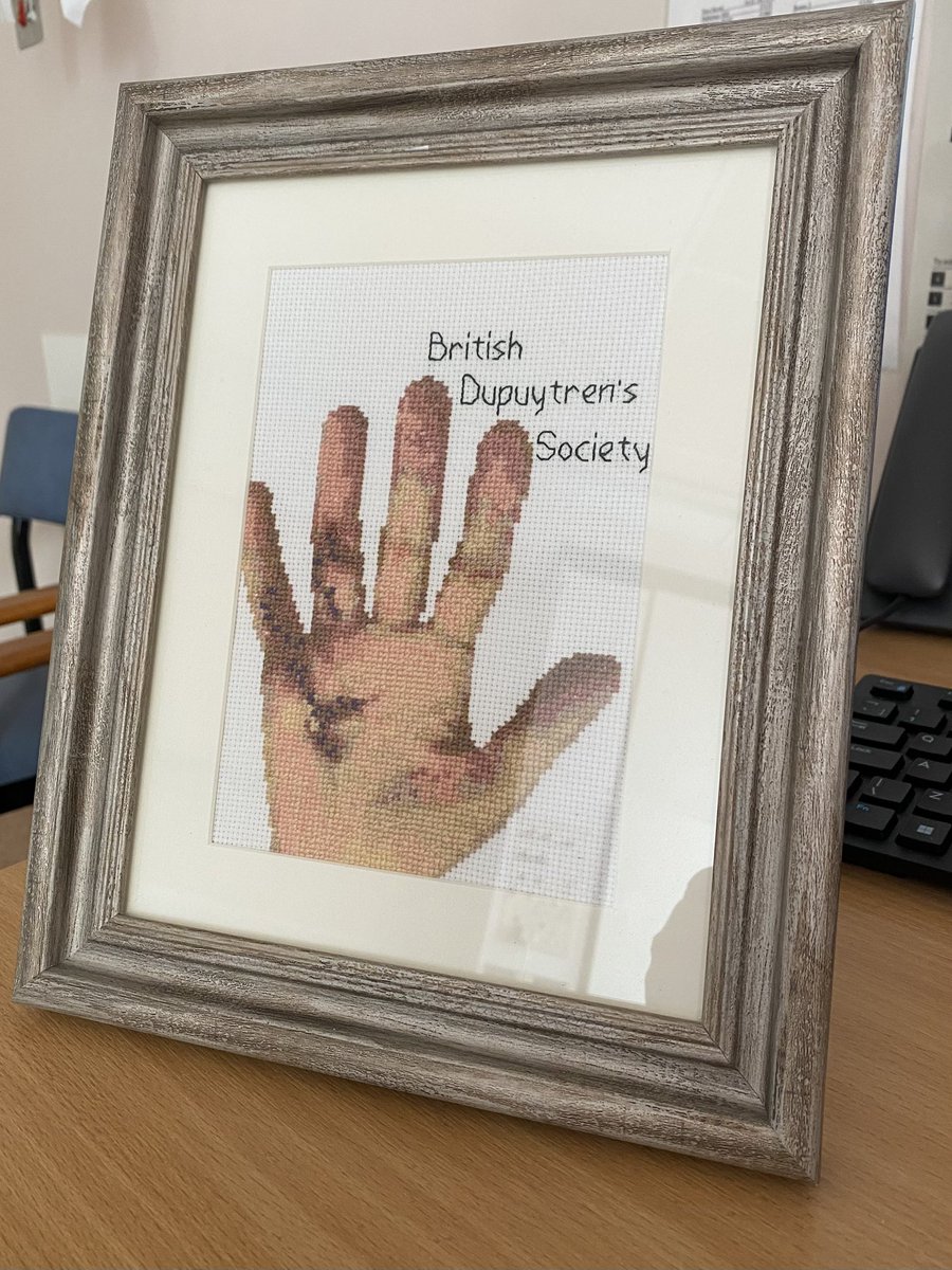 Thanks to <a href="/Dupuytrens/">Dupuytren Society UK 💙🇺🇦</a> society for this impressive cross stitch piece. This will be mounted in Hooper Hand Unit at St John’s hospital.
