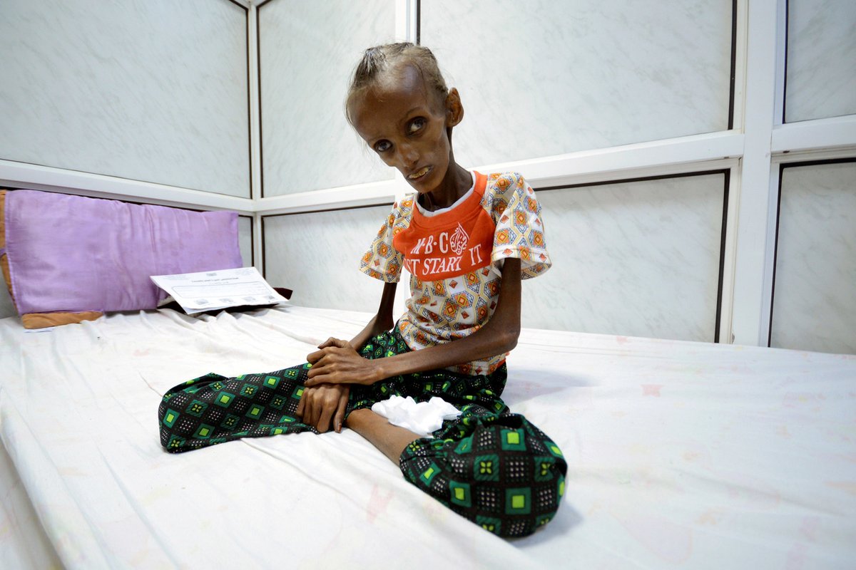 kennardmatt's tweet photo. In the years before the US-UK backed Israel's genocide in Gaza, both countries were key supporters of Saudi Arabia's savage war on Yemen, which imposed a man-made famine that pushed 2.3 million kids to brink of starvation.

This is who we are. How much more evidence do you need? https://t.co/St4e5lb8qq