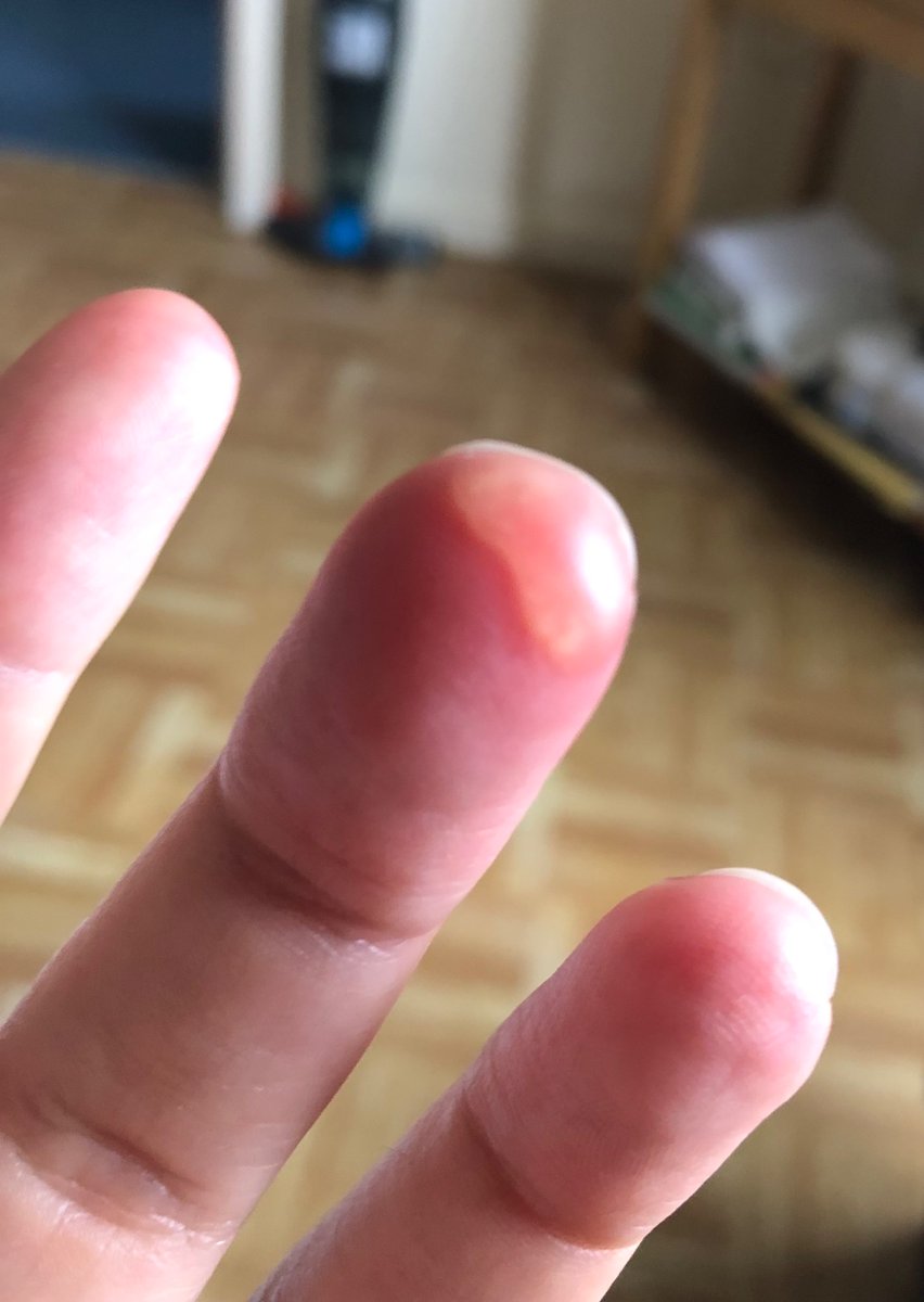 Romyann Brooks tweet media