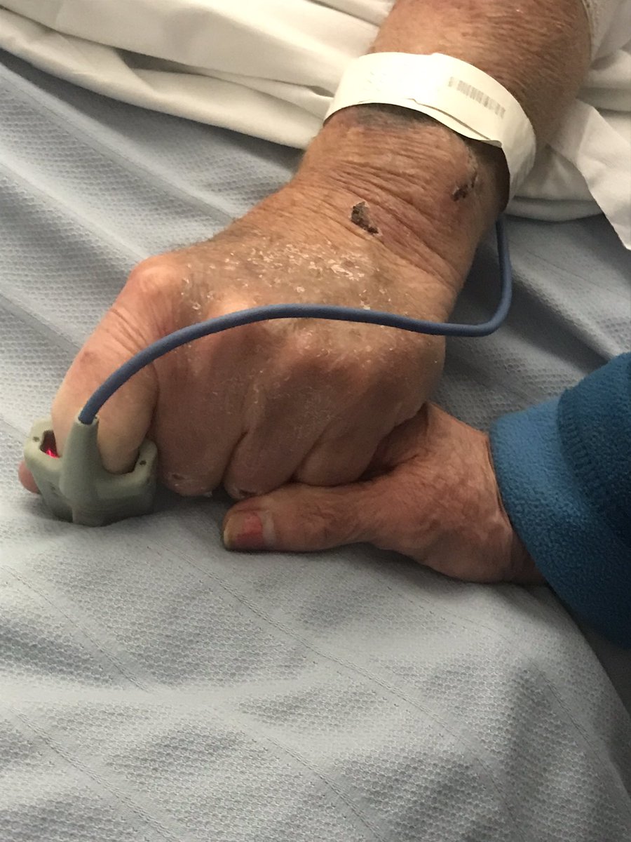 In the last 40 hrs we have had 3 hrs sleep as Dad has been critically ill. Nobody has given up, most of all the awesome <a href="/NHSuk/">NHS</a> staff <a href="/royalhospital/">Chesterfield Royal Hospital NHS FT</a> who are all incredible. <a href="/MarcusCason1/">Marcus Cason</a> said he’s not just my dad but my best friend and tonight he held hands with mum full of life x