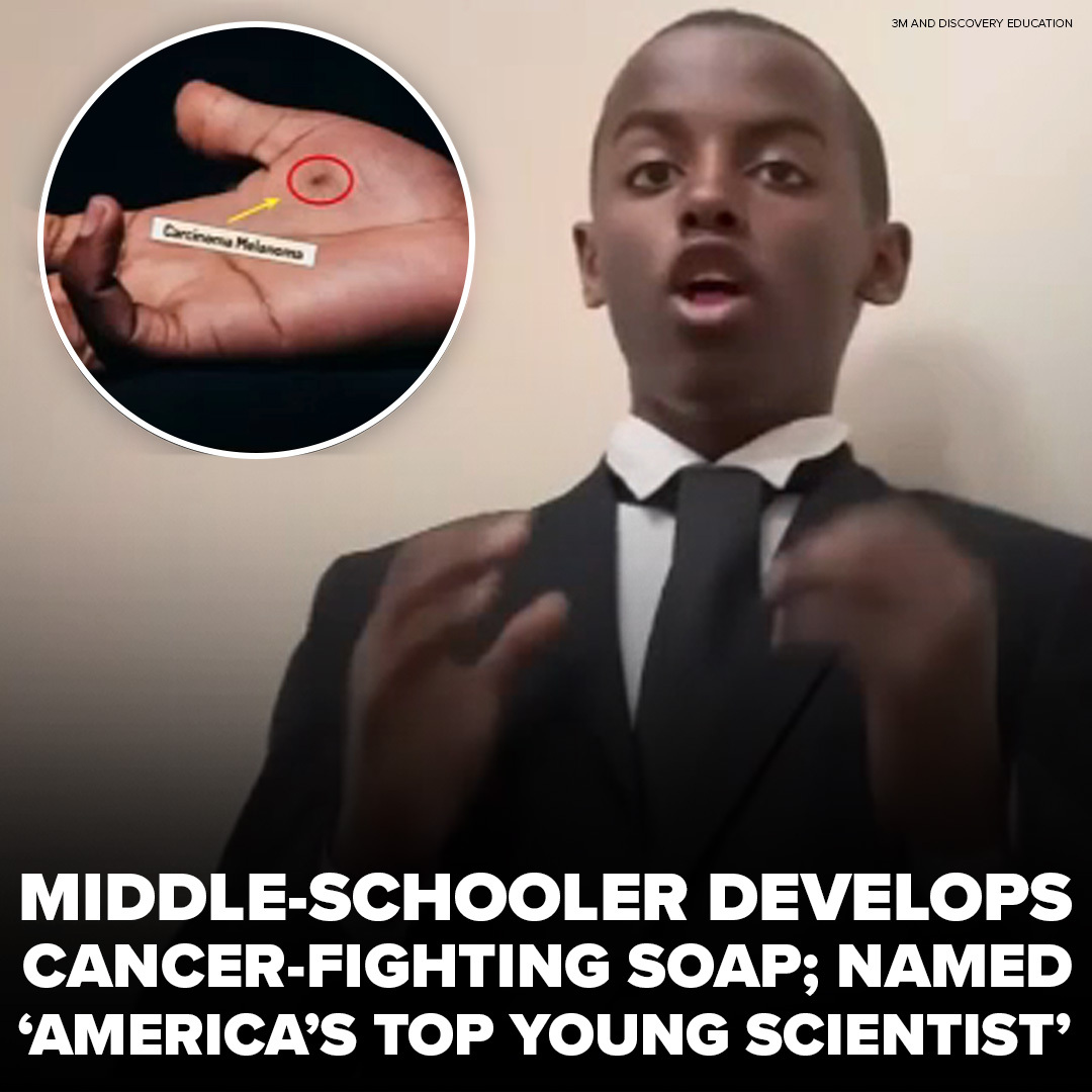 ABC7's tweet photo. Meet Heman Bekele. At just 14 years old, this middle-schooler developed a bar soap that can help treat melanoma🧼 https://t.co/4aa8K13jsR https://t.co/PqUjfyzUdR