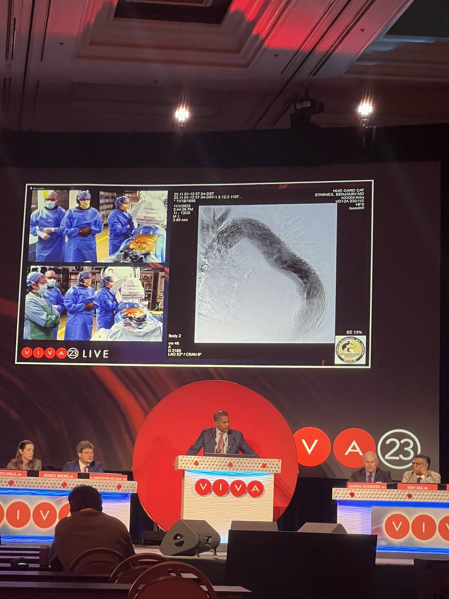 UW Vascular (@uwvascsurg) on Twitter photo Drs Zettervall Starnes & Sweet showcased clinical brilliance + exceptional skill in a live TBE case at #VIVA23 Complex endo aortic repair executed with meticulous planning and technical excellence An invaluable learning experiences for all attendees <a href="/SZettervallMD/">Sara Zettervall</a> <a href="/benstarnesmd/">Benjamin Starnes</a> Drs Zettervall Starnes & Sweet showcased clinical brilliance + exceptional skill in a live TBE case at #VIVA23 Complex endo aortic repair executed with meticulous planning and technical excellence An invaluable learning experiences for all attendees <a href="/SZettervallMD/">Sara Zettervall</a> <a href="/benstarnesmd/">Benjamin Starnes</a>