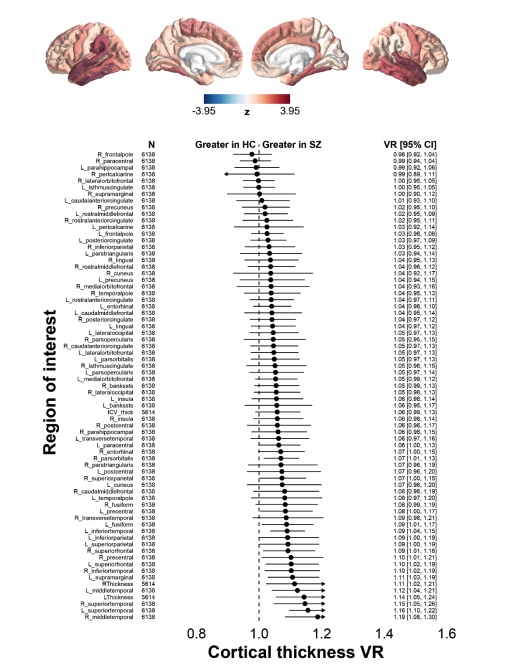 ParkvilleGeek's tweet photo. Estimating multimodal brain variability in schizophrenia spectrum disorders: A worldwide ENIGMA study | #bioRxiv https://t.co/FDSfcUpjQr https://t.co/9xgqdLJJqd