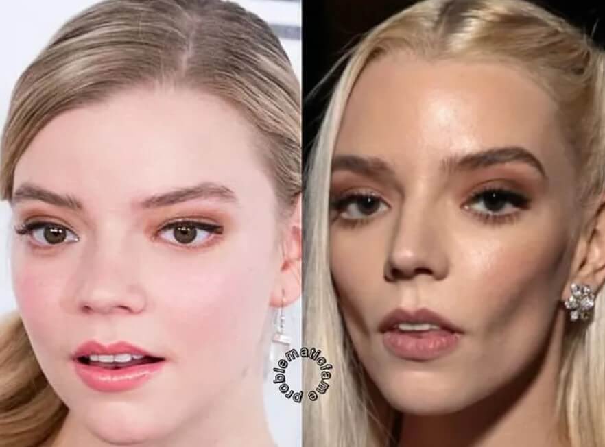 shoe0nhead's tweet image. i dont have very strong opinions on cosmetic surgery but BUCCAL FAT REMOVAL should be ILLEGAL and the criminal surgeons HANGED in the TOWN SQUARE