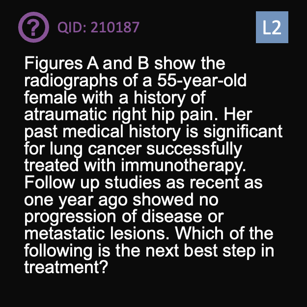 orthobullets's tweet photo. Can you answer this daily question from our Free QBank correctly?
QID: 210187
Comment your answer below, then check to see if you got it correct by clicking the link below to see the answer & explanation.
https://t.co/evWJ1IXy2u
#orthotwitter #MedTwitter https://t.co/qcU3vXDwEq