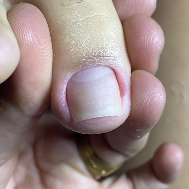 nunesnails_'s tweet photo. Cutilagem e esmaltação perfeita sim 😮💨
#pés #pedicure #cutilagemperfeita #cutilagem #cutilagemfunda #cutilagemfundinha #semdor #riodejaneiro #riodasostras #regiaodoslagos https://t.co/SxwiImBmz9