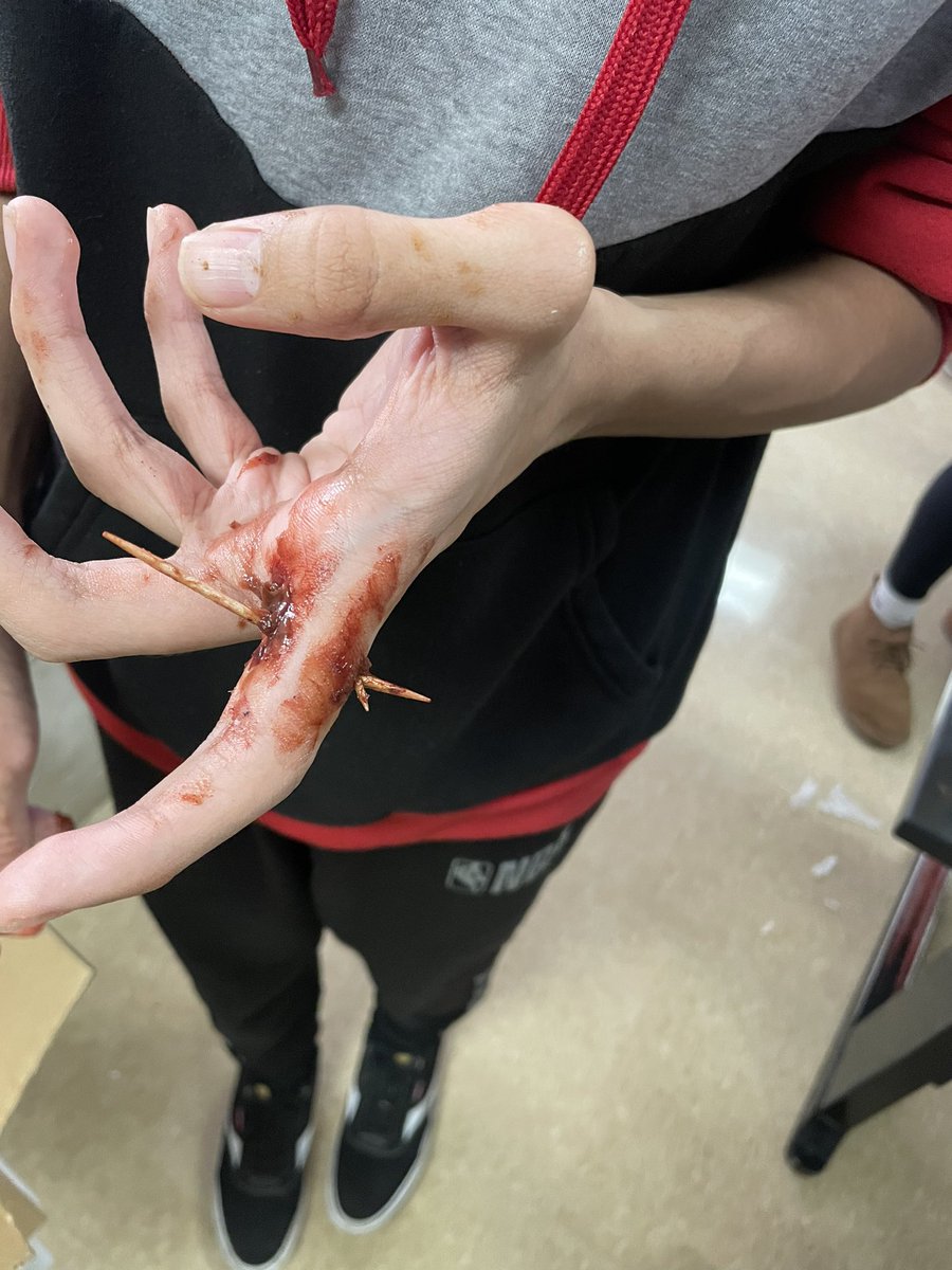 MrsCarroll25's tweet photo. Halloween fun! Cemetery Lab looking at pre and post 1900 birth year survivorship rates in AP Enviro and the wound lab looking at skin layers and anatomical terminology in AS A&amp;P! https://t.co/56kYgtSooq