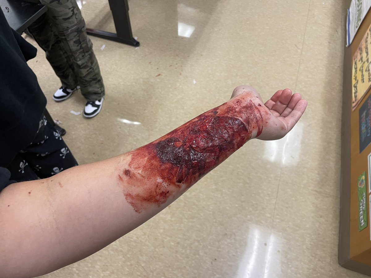 MrsCarroll25's tweet photo. Halloween fun! Cemetery Lab looking at pre and post 1900 birth year survivorship rates in AP Enviro and the wound lab looking at skin layers and anatomical terminology in AS A&amp;P! https://t.co/56kYgtSooq