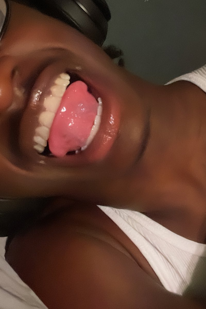 wolfgalleryy's tweet photo. teeth thread? https://t.co/SngpJOKpee