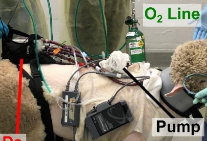 🤩Truly work of a village🤩 Check out our🔥study📜 led by @UkitaRei @MatthewBacchet1🐑 sheep w/ inducible pulmonary 🫁 HTN+RV dysfxn supported w ‼️7 DAYS😱 of AMBULATORY mechanical circulatory support! @VUMC_heart @VUMCLung @VUMCTransplant @VUMCSurgery jhltonline.org/article/S1053-…