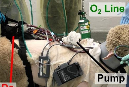 🤩Truly work of a village🤩 Check out our🔥study📜 led by <a href="/UkitaRei/">Rei Ukita</a> @MatthewBacchet1🐑 sheep w/ inducible pulmonary 🫁 HTN+RV dysfxn supported w ‼️7 DAYS😱 of AMBULATORY  mechanical circulatory support! @VUMC_heart @VUMCLung @VUMCTransplant @VUMCSurgery 
jhltonline.org/article/S1053-…