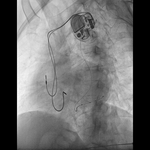 Dimitris Katsaras tweet media