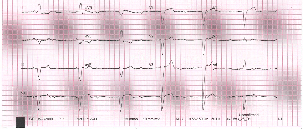Dimitris Katsaras tweet media
