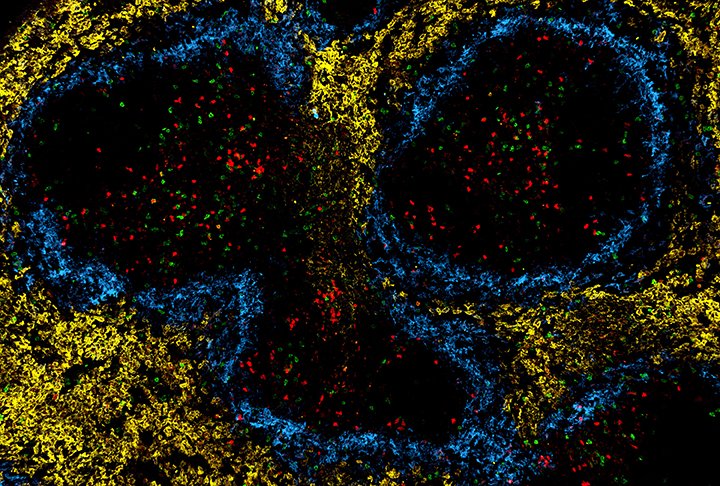 #Immunology: disfunction of #mitochondria drives the #exhaustion of #TCells: new paper @NatureComms. Congratulations to Martin Väth @Wue_SI, work funded @dfg_public ➡️uni-wuerzburg.de/en/news-and-ev…