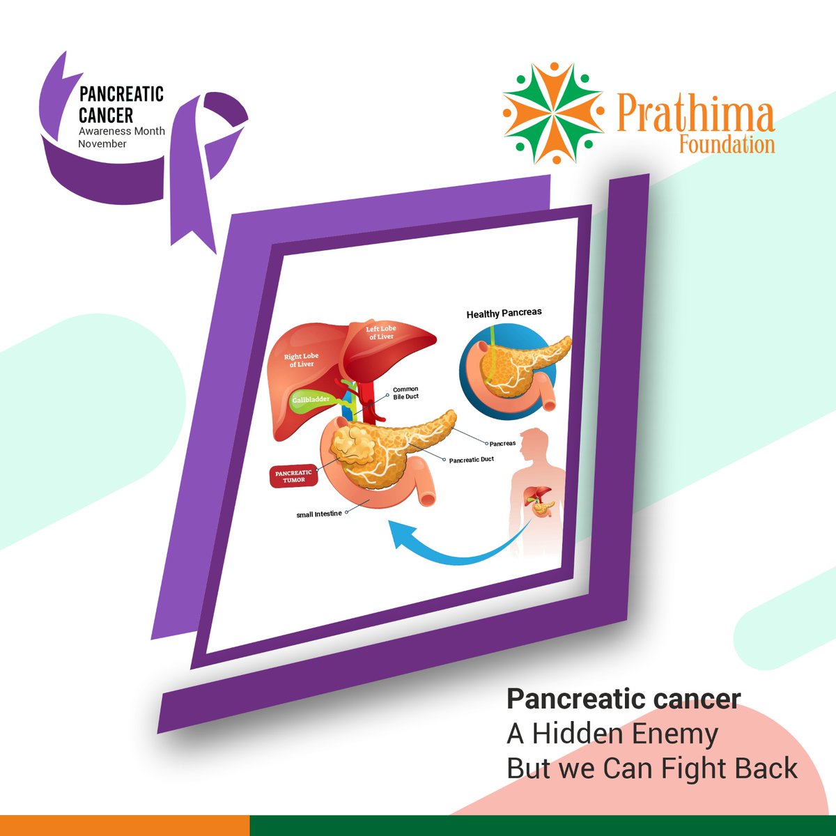'Pancreatic cancer', A Hidden Enemy But we Can Fight Back.

#PancreaticCancerAwareness #WageHope #DemandBetter #PANCaware #KnowItFightItEndIt #EarlyDetectionSavesLives #PurpleForAPurpose #PancreaticCancerWarrior #HopeForACure #trendingnow #prathimafpundation #prathima #PF