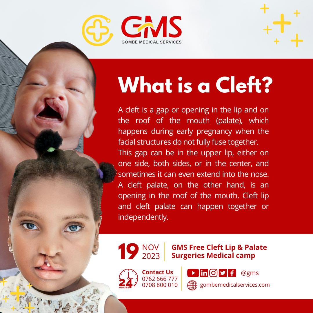 Gombe medical services is organizing a free cleft lip and palate surgeries medical camp for both children and adults on the 19th of November 2023.
Theme: “Every person deserves to Smile” 

#GombeMedicalServices #CleftLip #MedicalCamp #Surgery #Hospital