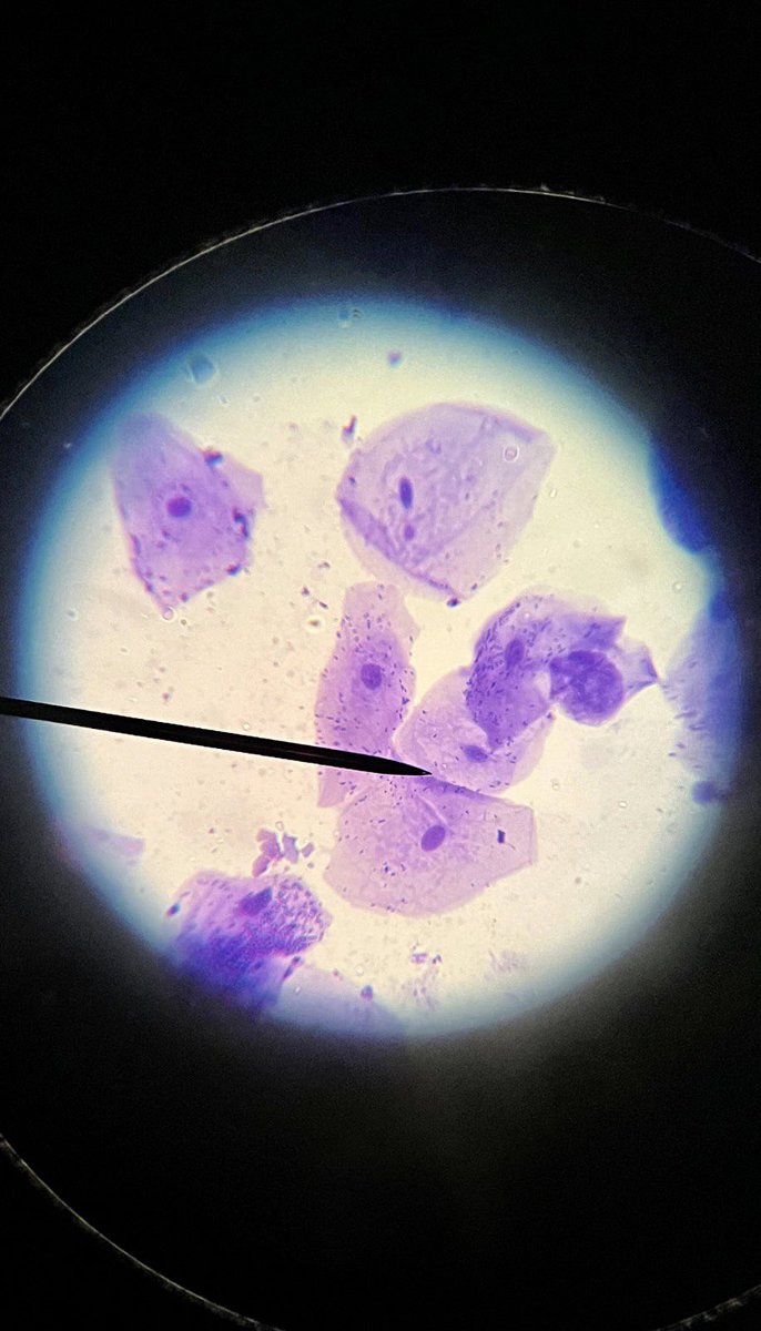 Esta semana, nuestros alumnos de 3ESO han hecho  un experimento, en la clase de Biología y Geología, para ver al microscopio las células humanas que están estudiando y dibujando en los espacios de aprendizaje. 🔬🧐

#secundariaSG #educaresnuestrapasiónSG
