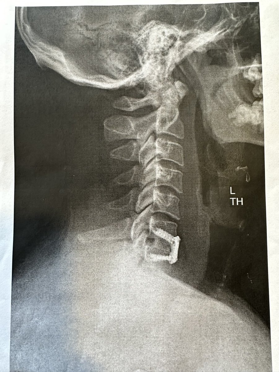 Erik_WWE's tweet photo. Extremely thankful for Dr Cordover and his staff at Andrew’s Sports Medicine and to @WWE for always making sure I have the best care possible. 

C6/C7 fusion surgery was successful and recovery begins now. 

I’m excited for my cybernetic upgrades to come fully online. https://t.co/uS6cz2bwTp