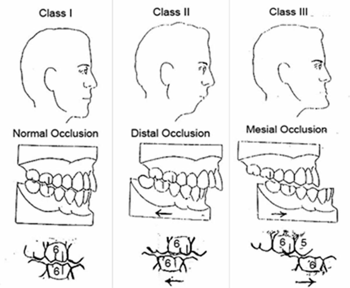 Most dental problems come down to 1 thing: A poor diet. A diet high in ...