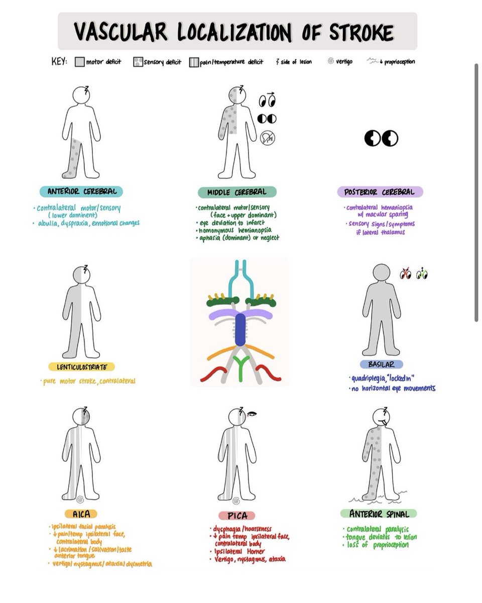 chrost_hugo's tweet image. An infographic showing vascular localization of stroke.  
Credits: Sarah Lyon  
#MedTwitter