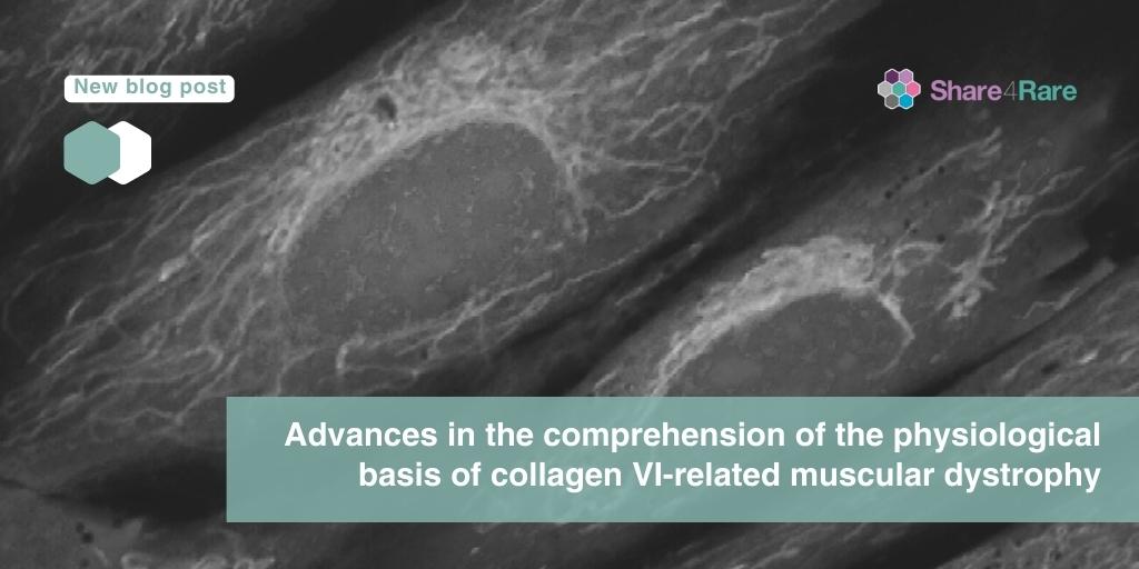 Share4Rare_eng's tweet photo. 👩‍🔬🧫 A Spanish research team led by the @IRSJD_info has characterised extracellular vesicles in patients with #collagenVI related muscular #dystrophy, shedding light on their link to cellular mobility and disease development 👉 https://t.co/ulNtVbAPAq

#raredisease #COL6 https://t.co/tdRQOWoC2g