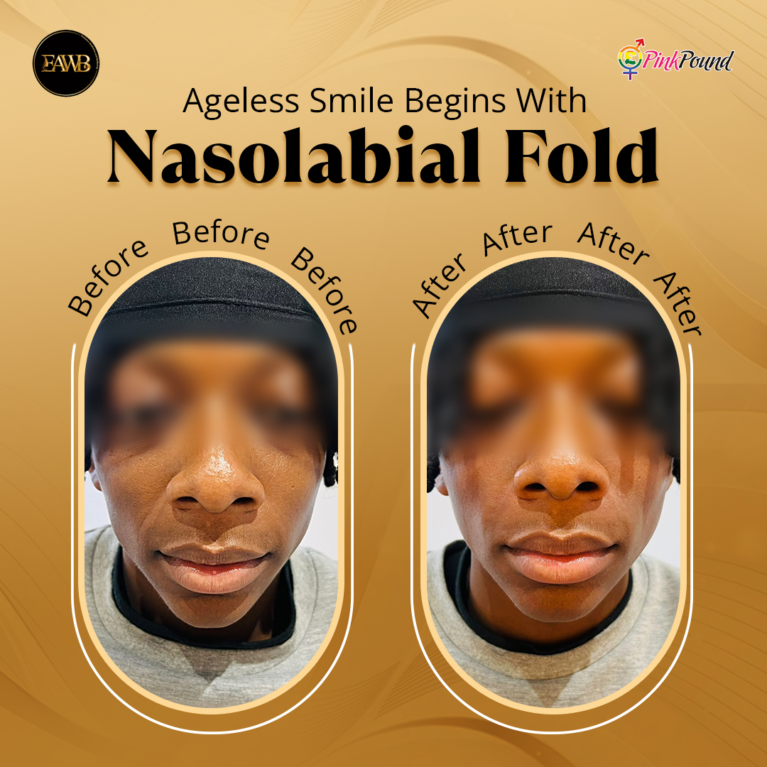 ExclusiveAawb's tweet photo. Your Dream Chin And Smile - Our Expertise
Chin Enhancement And Nasolabial Fold Treatments Are All You Need

Enhance Your Natural Looks, Reveal Your Radiant Smile With Us

Schedule Your Appointment Today
#chinenhancement #nasolabialfolds #treatment #beautycare #naturallooks https://t.co/PHZnJpCbsL