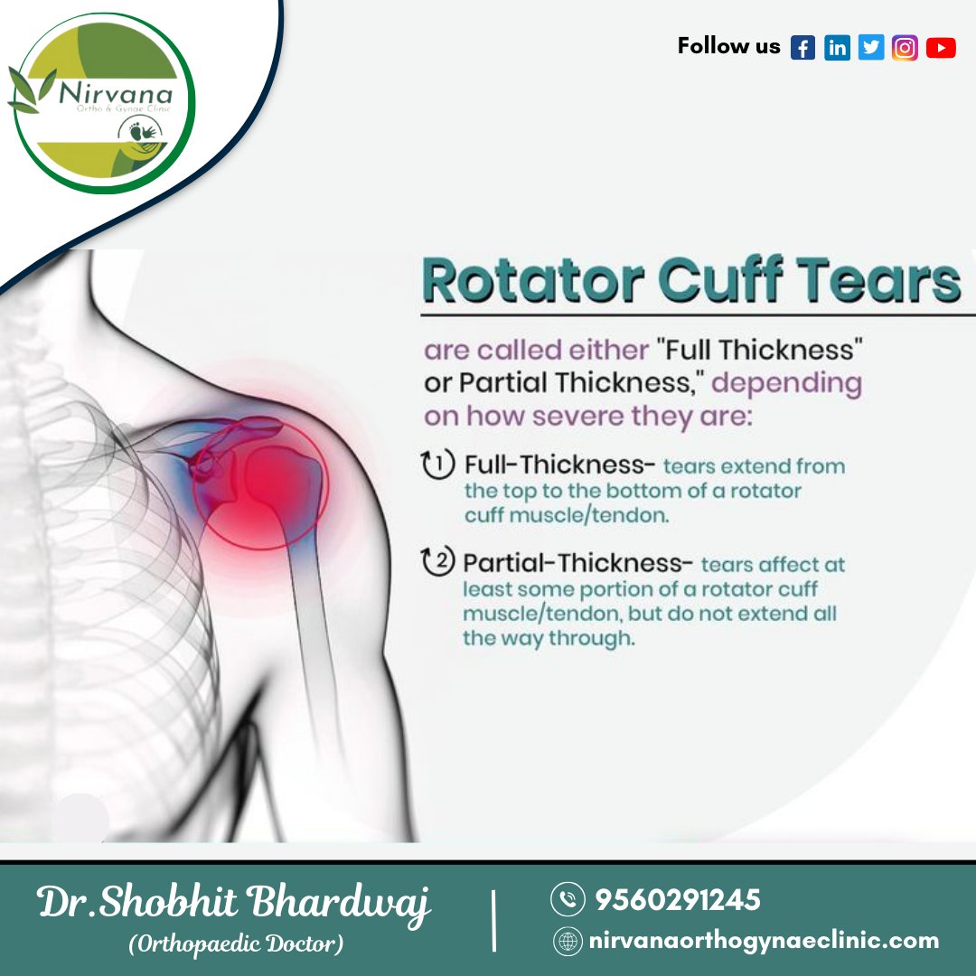 nirvanaclinics's tweet photo. Rotator Cuff Tears...
are called either "Full Thickness" or Partial Thickness," depending on how severe they are:
-
Book an appointment with Dr. Shobhit Bhardwaj (Orthopaedic Doctor in Noida)
📲 By Calling 0120-4153221, +919560291245, or 8700518439.
-
#RotatorCuffTears https://t.co/91w5ikRnnM