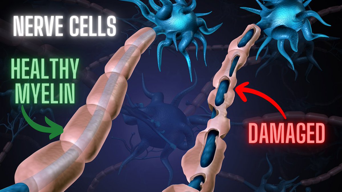 DrBPHealth's tweet photo. Myelin insulates your brain &amp; nerve cells

Myelin allows your brain &amp; nerves to transmit information faster

Myelin is 80% fat

We literally need dietary fat to think!

This is why low-fat diets are horrible for your health https://t.co/cBh9aUktwD