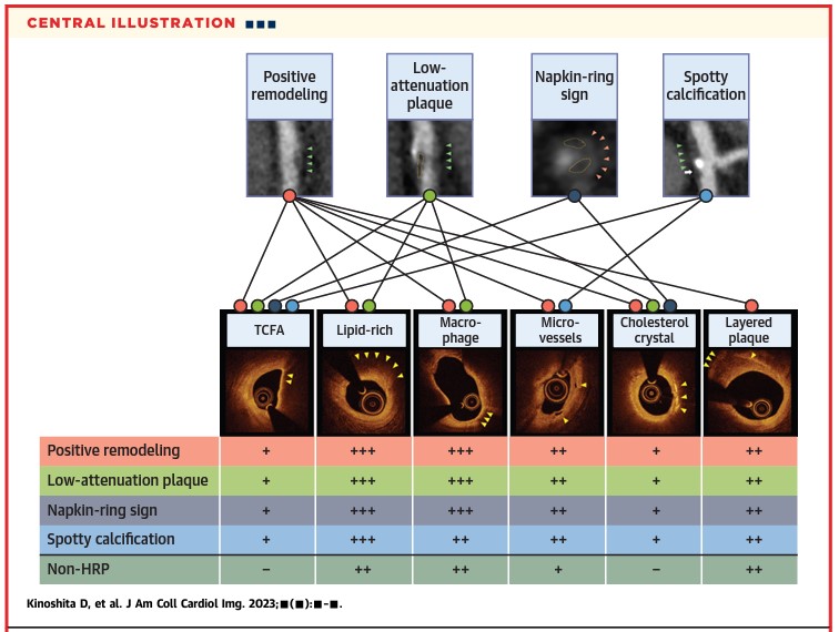 Are high-risk CCTA lesions consistent with OCT vulnerable plaques? In @JACCJournals Kinoshita et al explore the issue in >1,000 OCT/CCTA plaques sciencedirect.com/science/articl… @GreggWStone and I summarize this important step forward for vulnerable plaque in the accompanying editorial