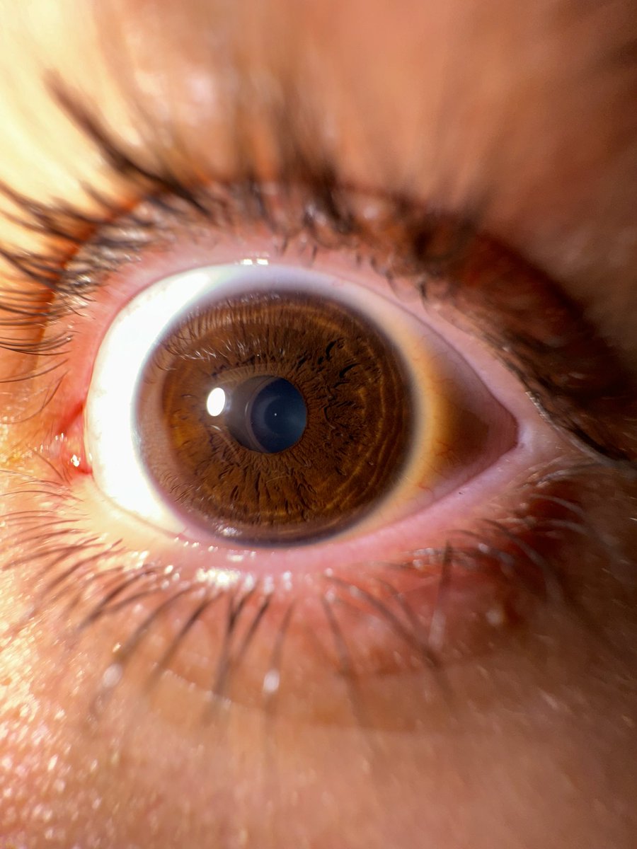 سُلی tweet media