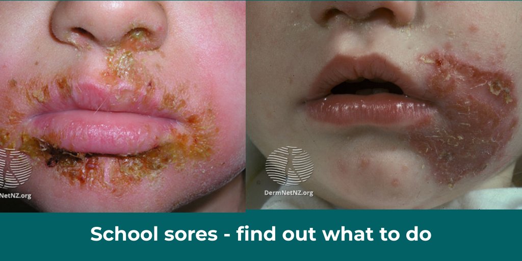 KidsHealth NZ tweet media