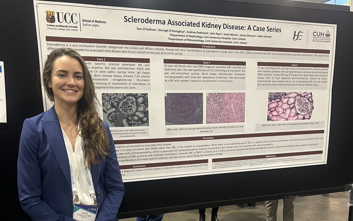 Cliona Cowhig (@clionacowhig) on Twitter photo Interesting series on biopsy findings in scleroderma <a href="/tmgosullivan/">Tara O’Sullivan</a> <a href="/sarah_m_moran/">Sarah Moran</a> <a href="/_JamesGleeson/">James Gleeson</a> <a href="/AdeelRafiAhmed/">Adeel Rafi Ahmed, MB BCh, FASN</a> Interesting series on biopsy findings in scleroderma <a href="/tmgosullivan/">Tara O’Sullivan</a> <a href="/sarah_m_moran/">Sarah Moran</a> <a href="/_JamesGleeson/">James Gleeson</a> <a href="/AdeelRafiAhmed/">Adeel Rafi Ahmed, MB BCh, FASN</a>