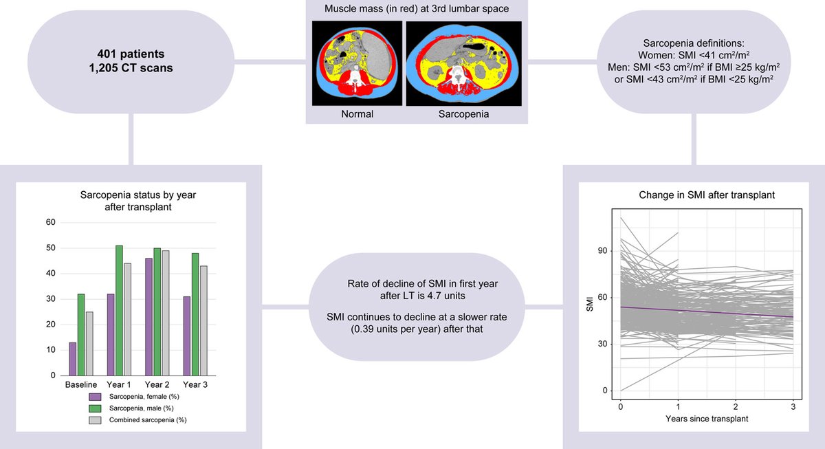 Cirrhosis-related sarcopenia may not resolve after liver transplantation

 🔓#OpenAcess at 👉jhep-reports.eu/article/S2589-…

#LiverTwitter