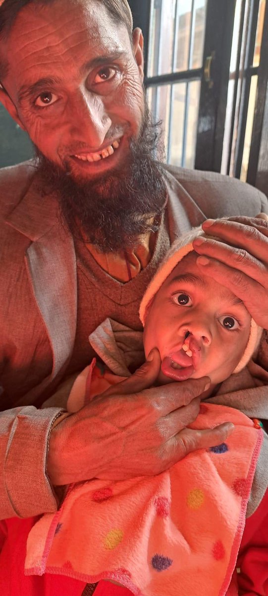 saklaindar's tweet photo. On 1st nov Free Assessmnt camp organized by Smile Train via Khyber Inst. Sgr in collaboration with DEIC GMC Handwara for Children with cleft lip &amp; Palate Deformities at Sarkoli kalaroose Kupwara. Many screened, Surgeries to be done free of cost. @SudanAyushi @NHMJK5 @dckupwara https://t.co/cFswmGuWSp