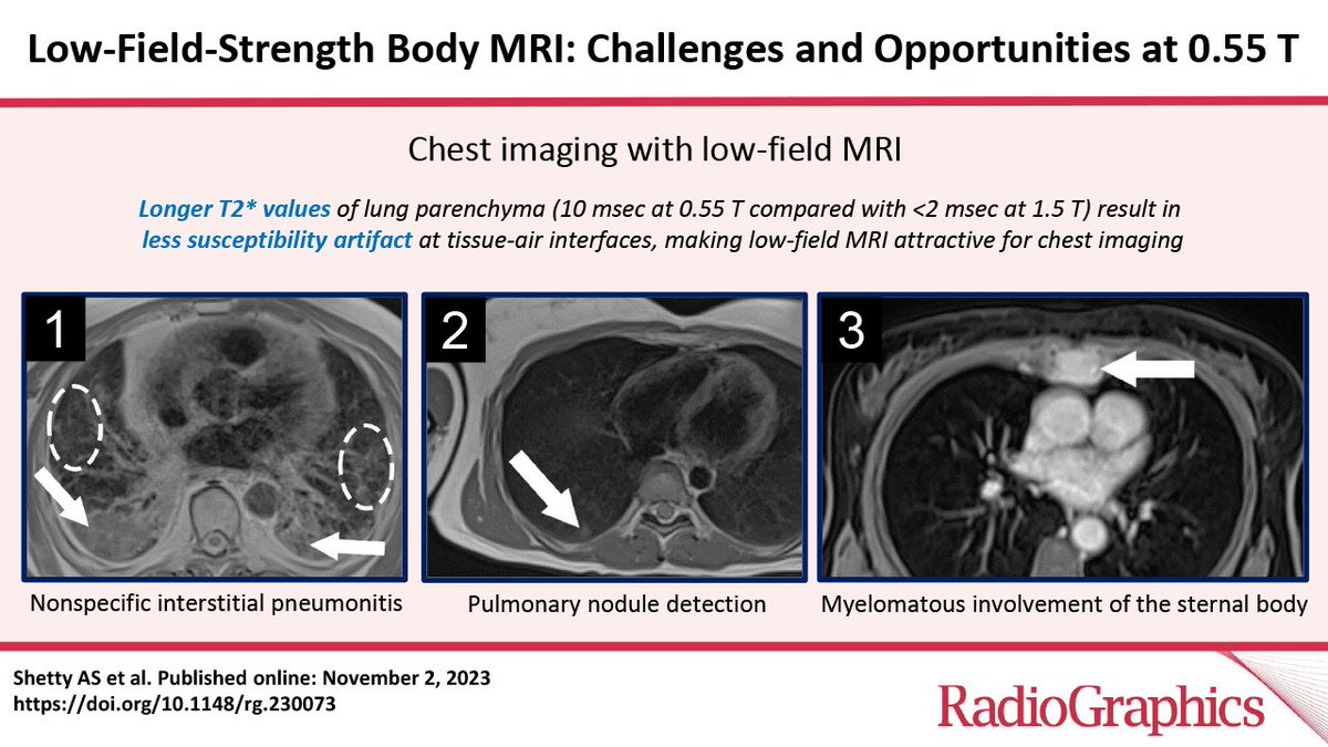 Low-field MRI @ 0.55T could provide benefits to expanding patient access, indications and safety for body MRI. Read more in @RadioGraphics at: pubs.rsna.org/doi/10.1148/rg… @MIRimaging @WUSTLmed